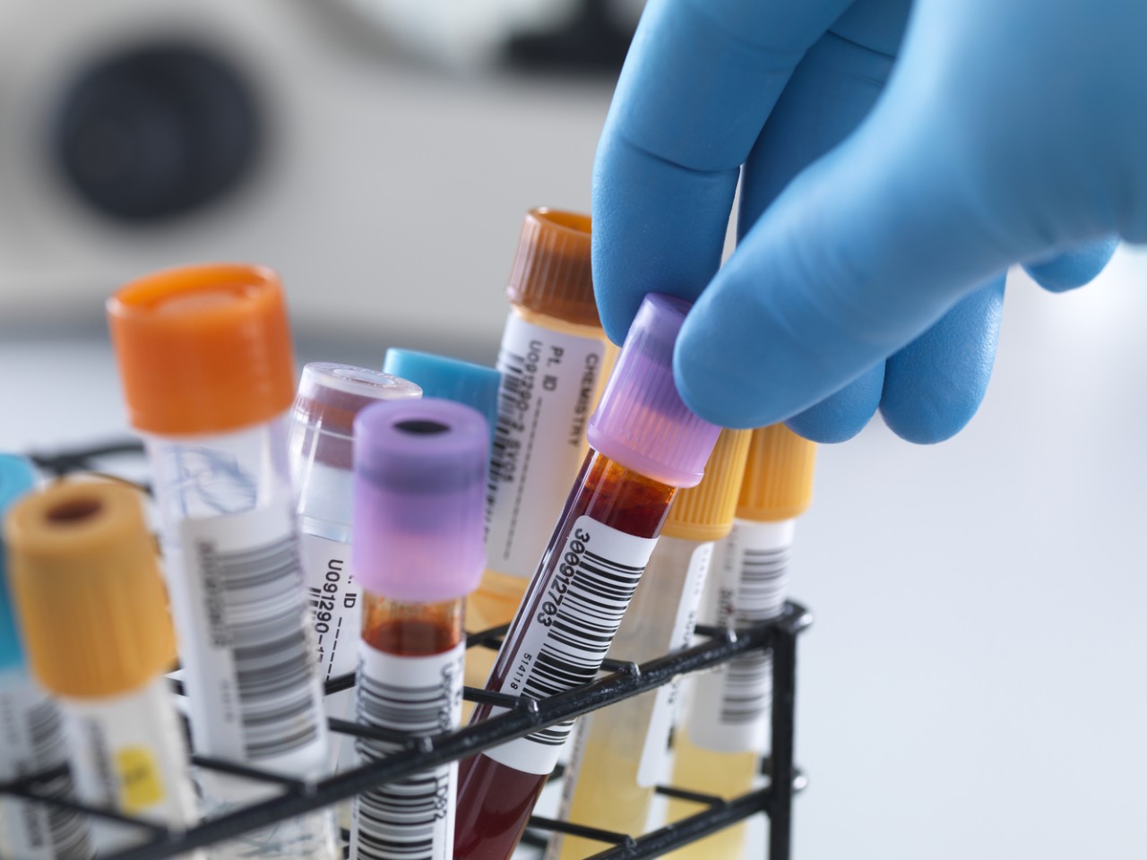 一致性评价大幕开启，医院市场即将调解