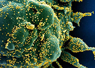 唾液检测新冠抗体新要领来了，获取效果仅需几小时！