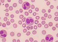 一种神秘颗粒被发明了！它能否成为败血症早筛标记物？