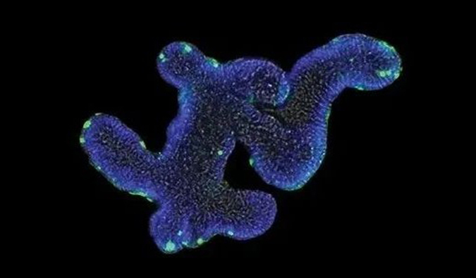 类器官——药物研发和药效评价的主要手艺